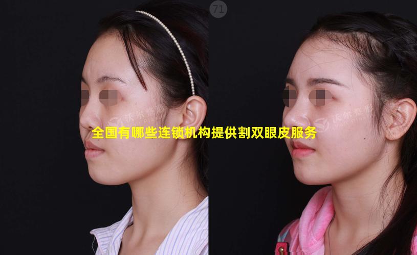 全国有哪些连锁机构提供割双眼皮服务
