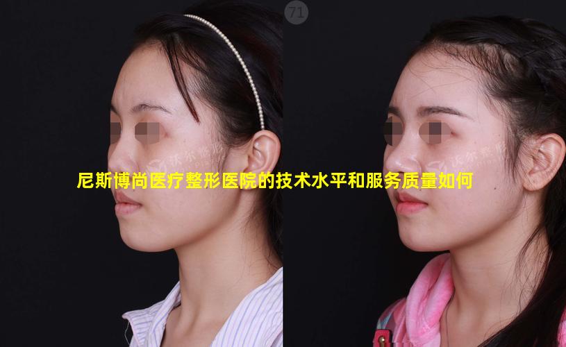 尼斯博尚医疗整形医院的技术水平和服务质量如何